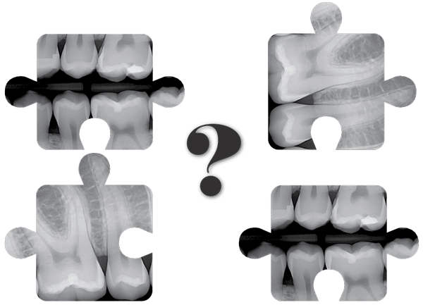 Dental Imaging integration with Patterson