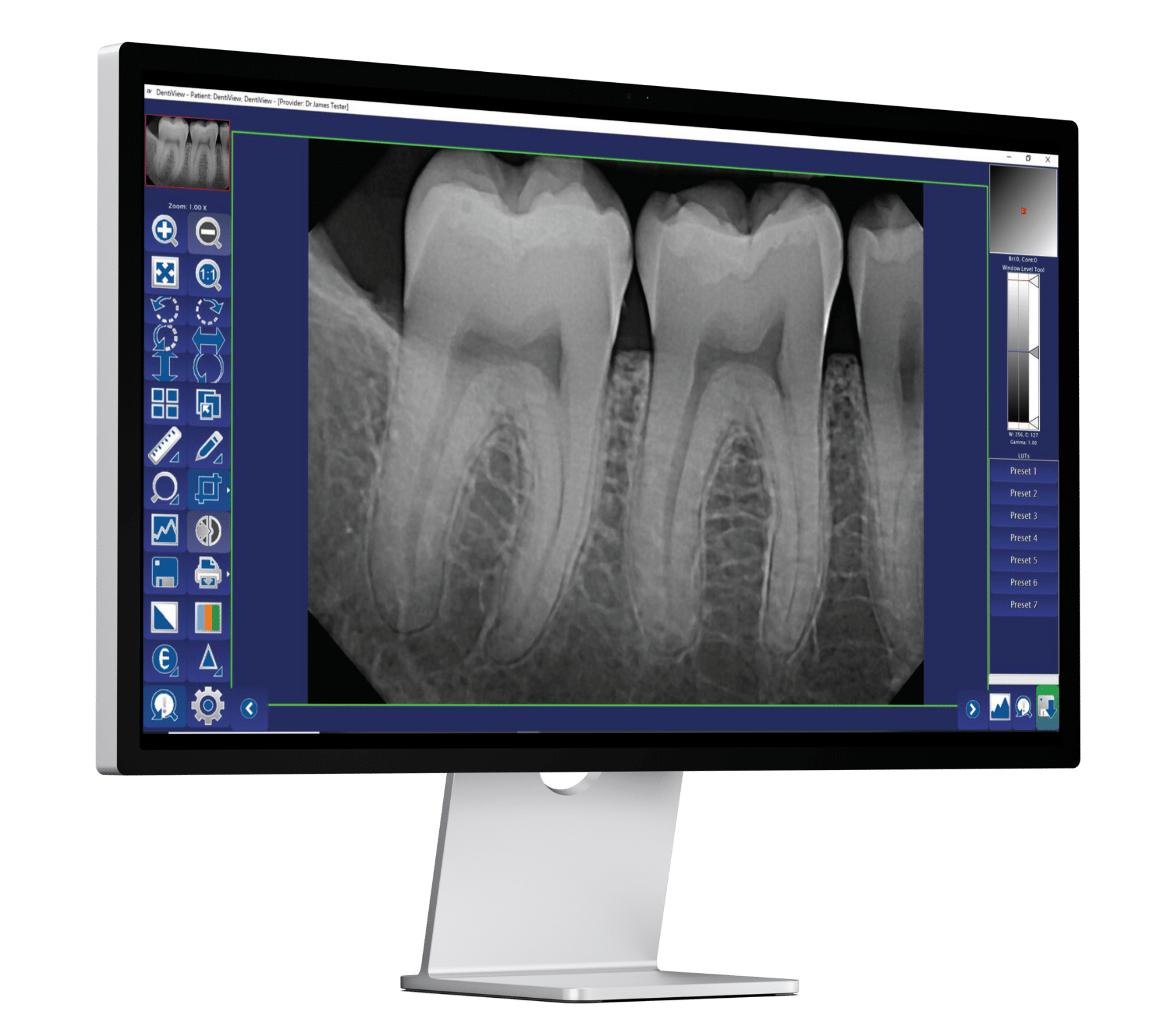 DentiView Imaging Software