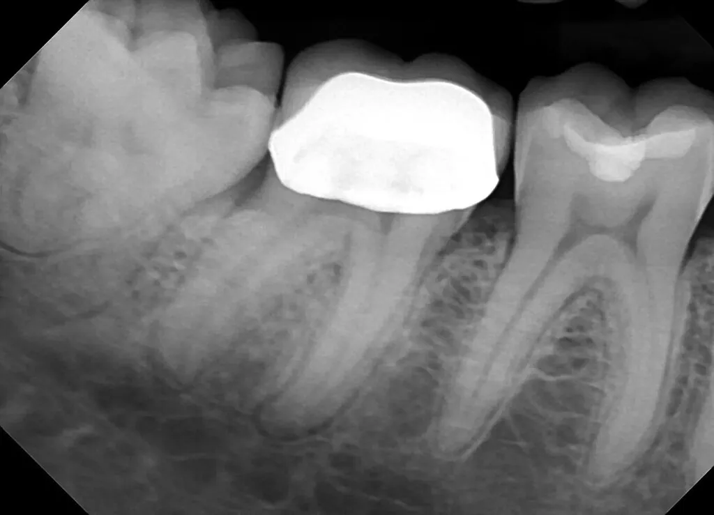 dream sensor x-ray 1